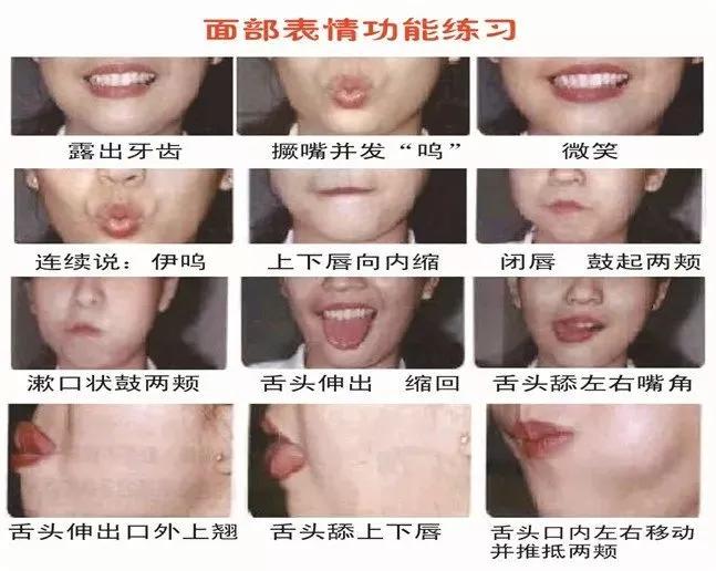 科普面瘫怎么治才是最有效的,预防面瘫吃什么药治疗