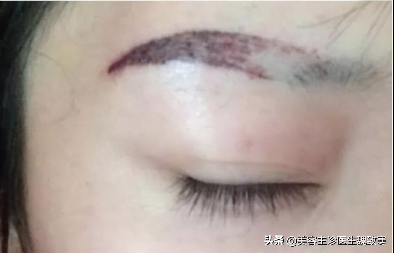 韩式纹眉有哪些种类,韩式纹眉痛吗