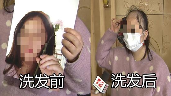 长沙女子做头发护理后变“秃头”店家这么回应