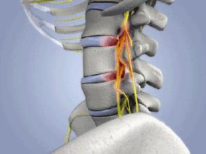 骨科什么病会导致头晕和耳鸣,骨科怎样治疗颈椎病引起头痛头晕