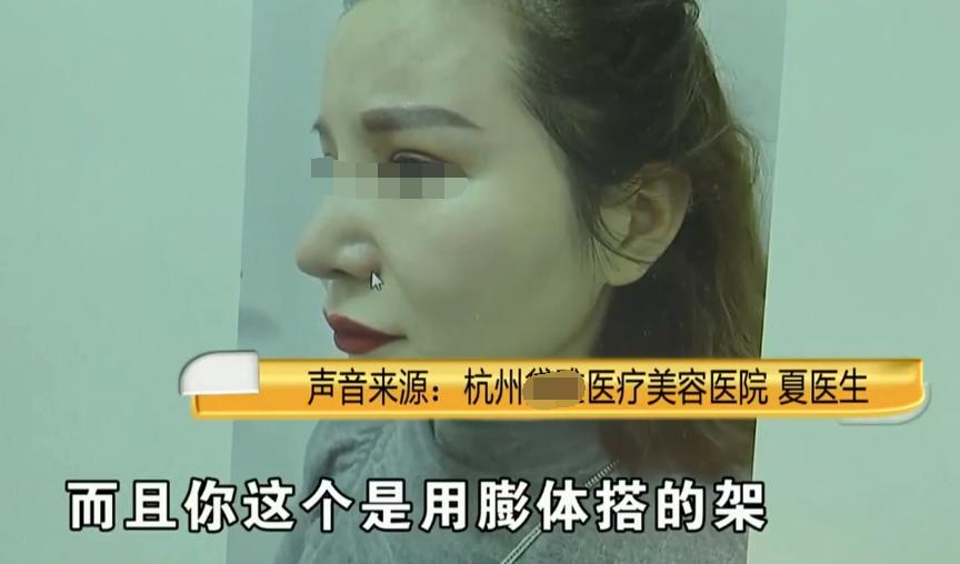 一弯腰就流鼻血？女子吃辣椒打喷嚏爆出“硬物”：我整个人都吓傻了