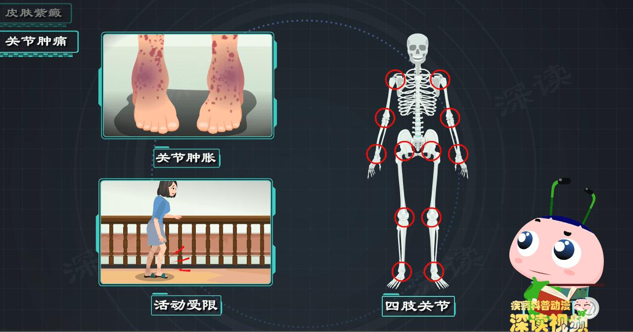 小孩腿上有紫癜发热了怎么办,婴儿腿上有紫癜但没有其他症状