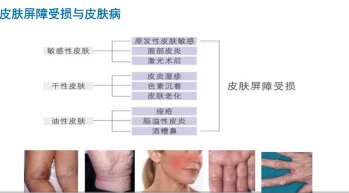额头皮肤暗沉怎么上粉底液,皮肤黑黄暗沉怎么选粉底液