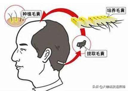 远离脱发的四个误区,脱发前的七大征兆