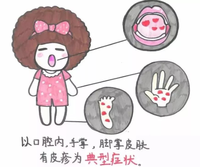 儿童买重大疾病保险有必要吗,有先天性疾病购买哪种保险合适