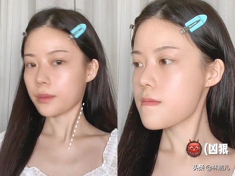 方脸如何变成鹅蛋脸教程,如何将方脸整成高级脸