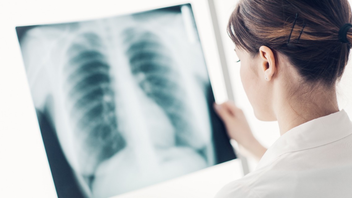 早期肺癌术后要不要辅助治疗？化疗？靶向？免疫？还是中医治疗？