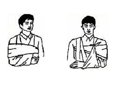 骨折后肿胀不能手术怎么办,骨折恢复过程中脚肿怎么办