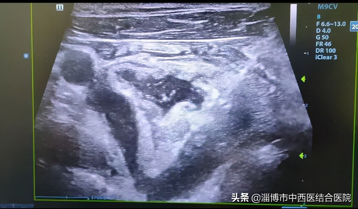 中西医结合中西合璧,中西结合中西合璧