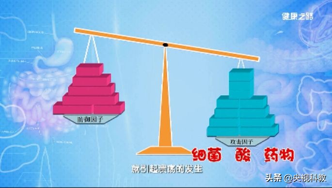 幽门螺旋杆菌胃出血怎么治疗,胃出血幽门螺杆菌患者可以吃什么