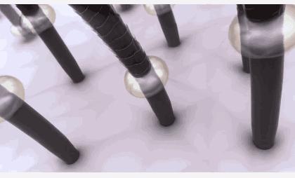 沙宣洗发水掉头发,沙宣洗发水洗了脱发