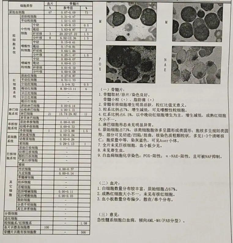 粒单不决问组化?有时还真不一定...