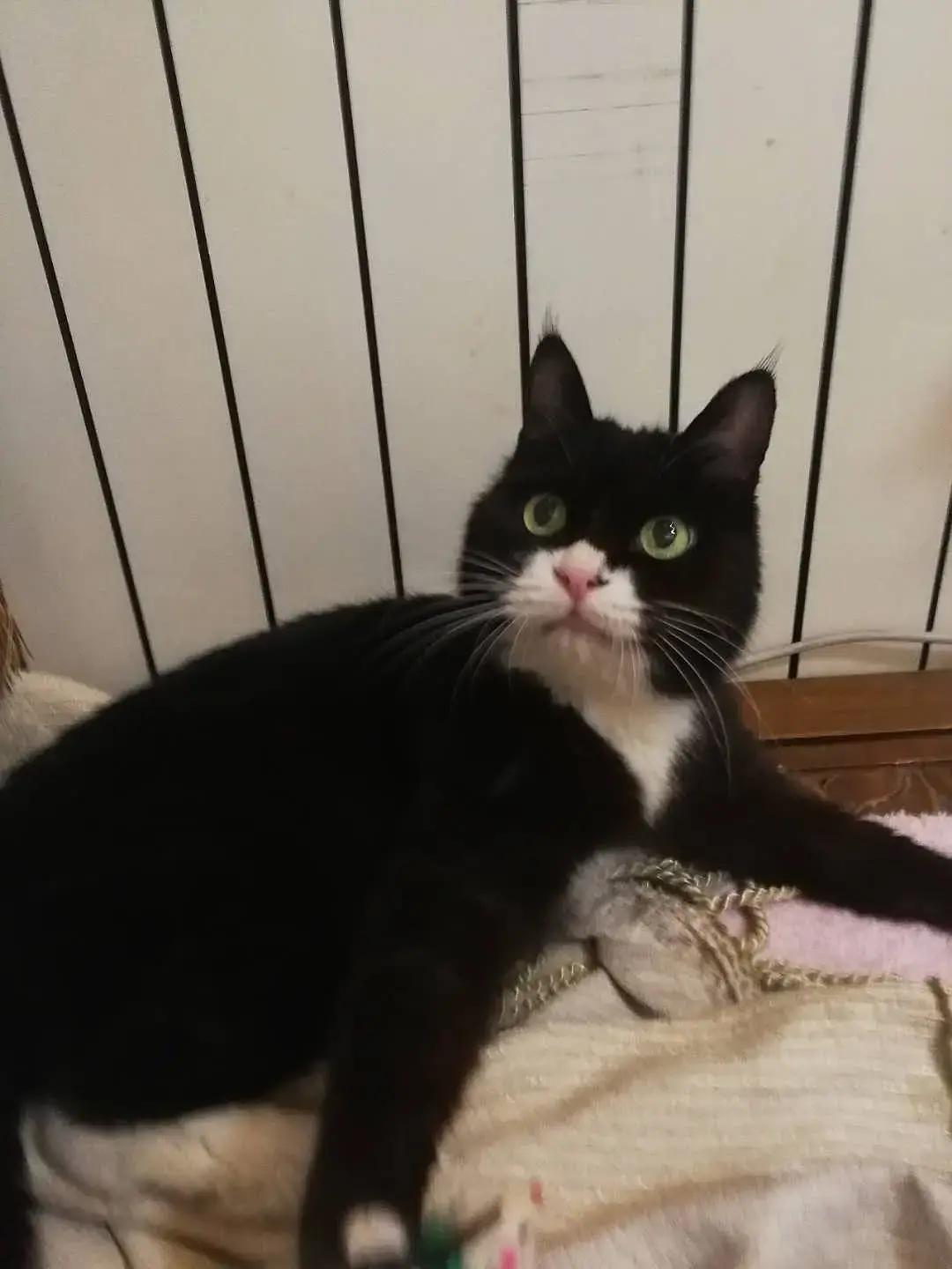 糖尿病患者胆囊炎胰腺炎同时出现,胆囊结石胰腺炎糖尿病