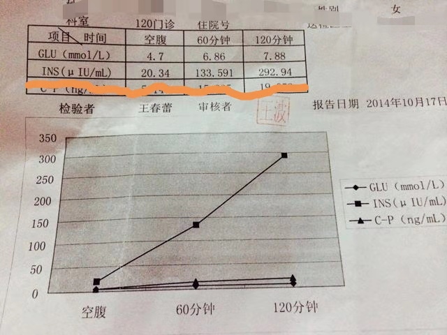 科普糖尿病患者尿液化验小常识,关于糖尿病相关指标的解读