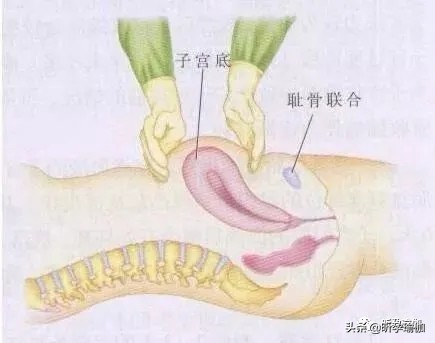 产后喂母乳可以促进子宫恢复吗,产后子宫护理注意事项