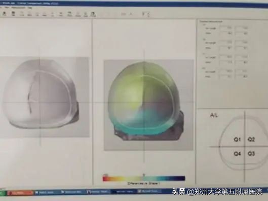郑州大学五附院康复科怎么样,郑州大学五附院儿科