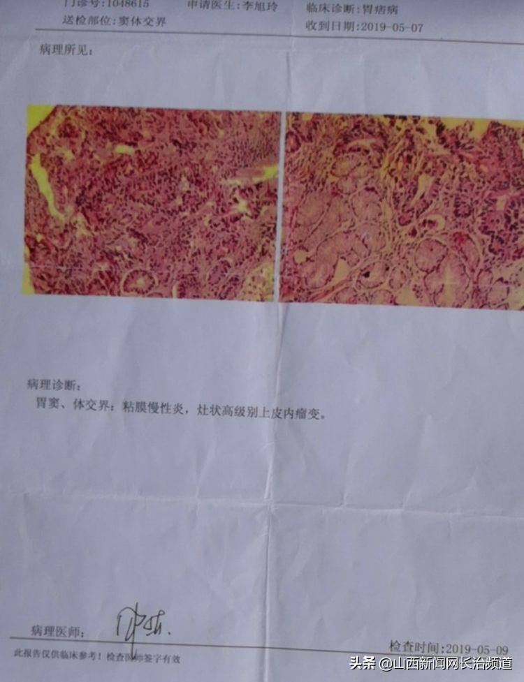 内镜下如何微创治疗早期胃癌,内镜微创治疗早期胃癌