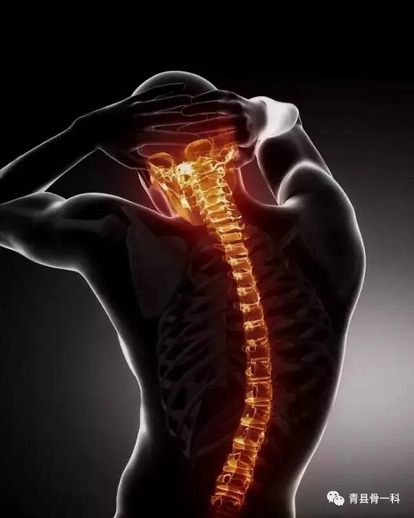 脊椎病有什么症状和表现,脊椎病有哪些明显症状