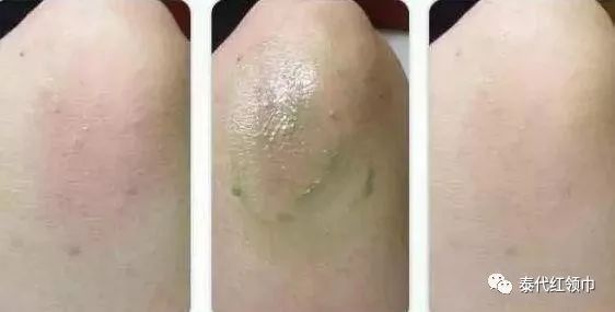 青草膏四季通用,滋润修复青草膏