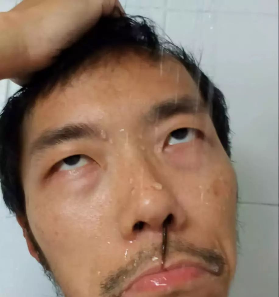 流鼻血的恐怖现象,流鼻血有多恐怖