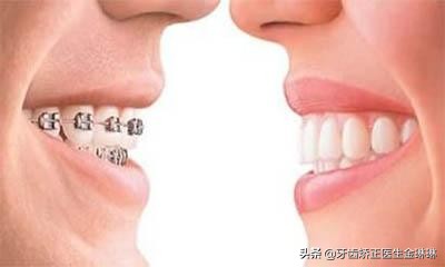 淄川口碑最好的矫正牙齿医院,淄博市口腔医院哪个专家整牙好