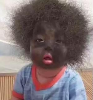 金英杰口腔解剖名师,金英杰探诊