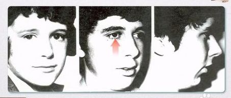 一个月宝宝口腔上颚白色的是什么,婴儿口腔上颚有一个小米样的白点