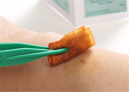 路医生说丨常用的皮肤伤口消毒剂「碘伏」，有没有毒？能不能用？