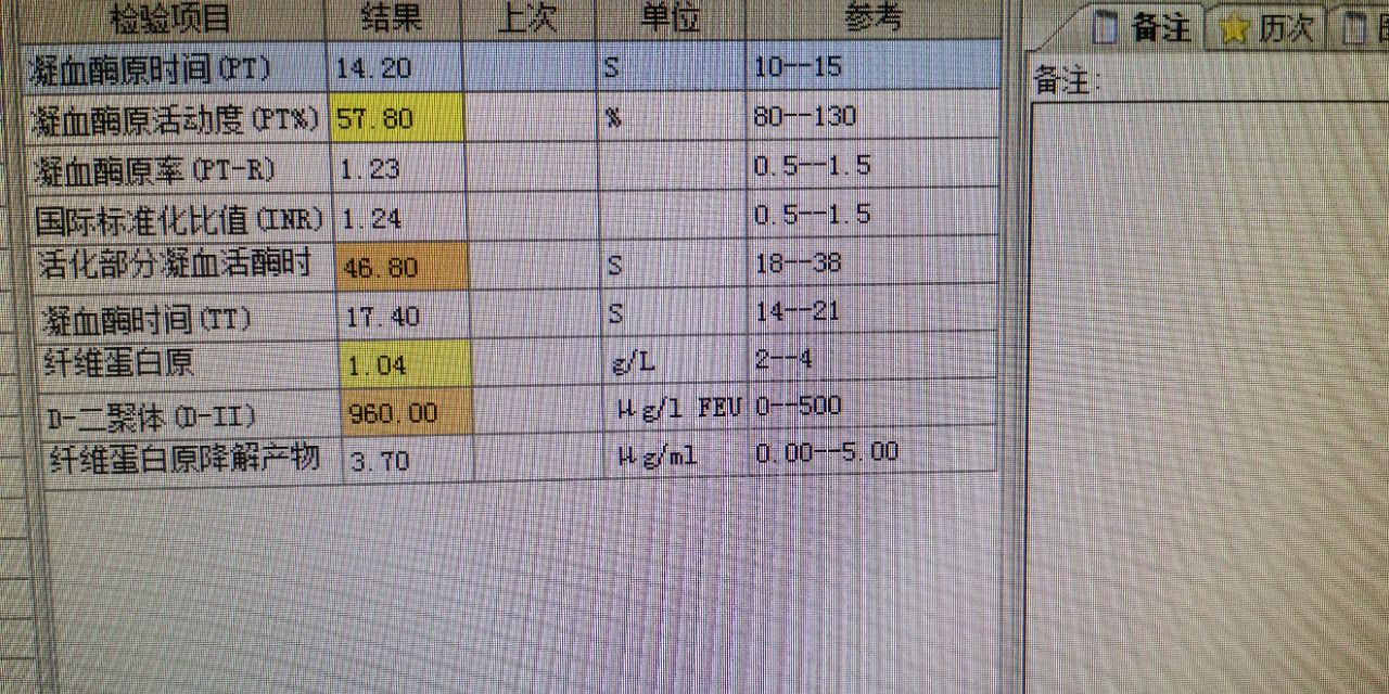 中西医结合治疗原因不明肠梗阻、腹水转氨酶明显升高病案一例！