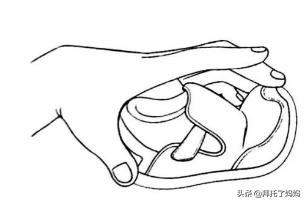 宝宝腿部弯曲不正常图片,宝宝腿畸形是因为什么