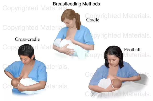 乳房皲裂怎么预防,比生孩子还痛的经历