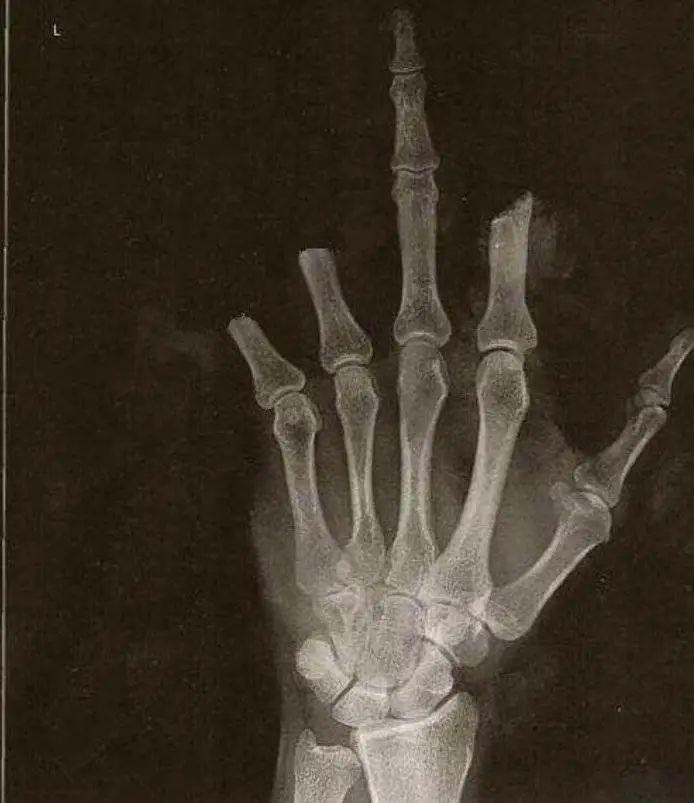 比尔盖茨还厉害吗,美国人讨厌比尔盖茨