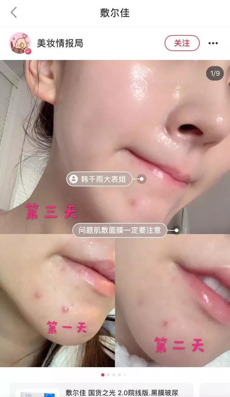 火遍日本的国产面膜,敷尔佳清痘面膜真实测评