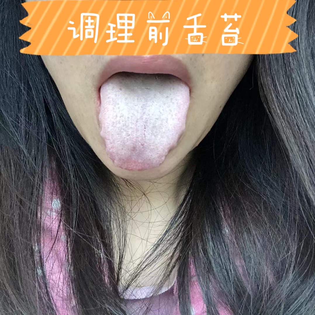 甲状腺结节子宫肌瘤卵巢囊肿调理,甲状腺乳腺结节子宫肌瘤如何调理