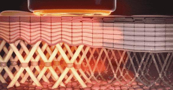 赵露思推荐好物清洁面部,赵露思推荐脸部小熨斗