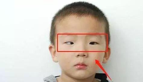 孩子玩手机眼睛变黑眼圈,小孩爱玩手机然后眼睛变黑了