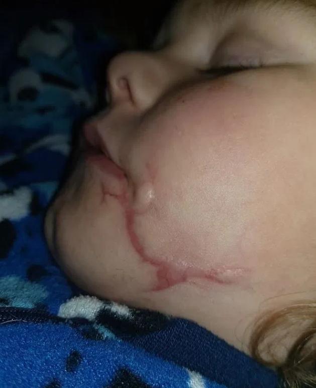 2岁男童被恶犬袭击怎么样了,孩子被恶犬袭击却将恶犬杀了