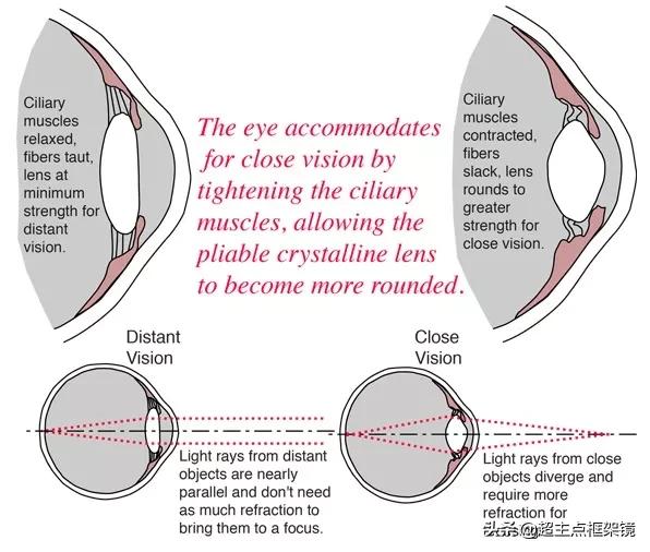 近视矫正仪器对儿童近视有用吗,儿童近视100度戴矫正镜有用吗