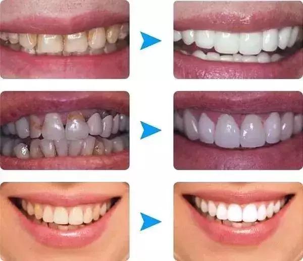 李湘贵妇,李湘美白牙膏