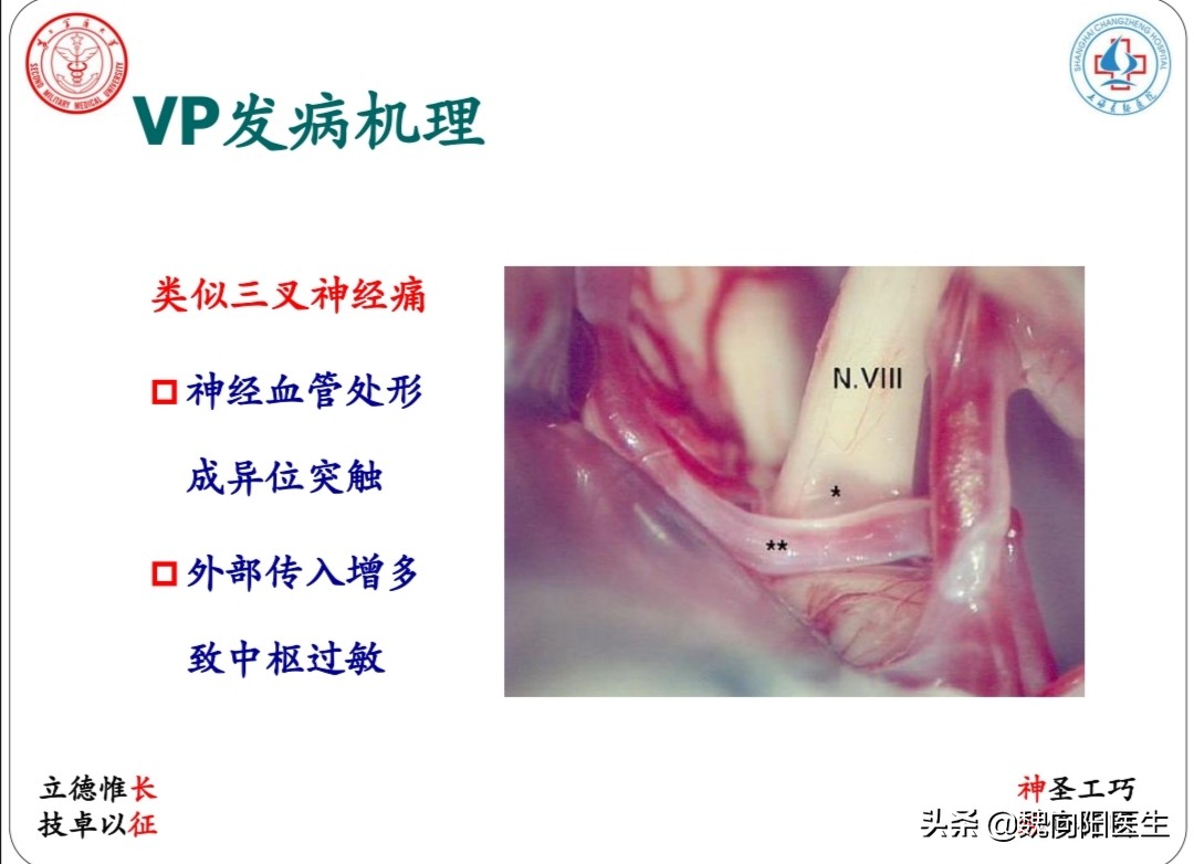 治疗眩晕头晕哪个医院好,头晕眩晕中医看什么科