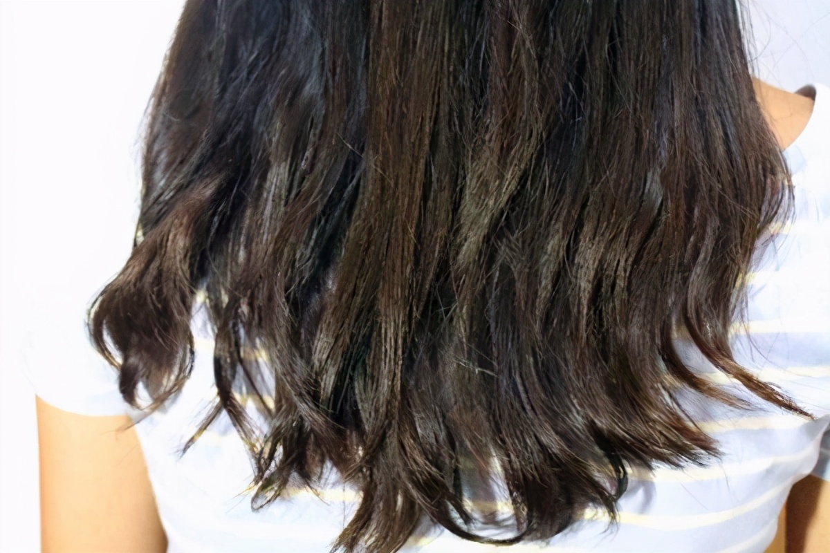 偶尔头皮屑多怎么去除最简单方法,头皮屑特别多有什么办法去除掉