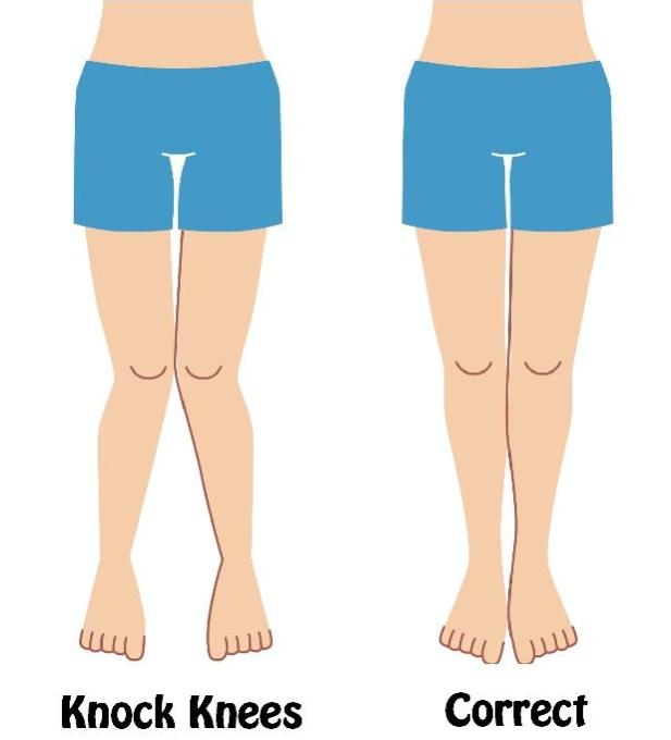 各种腿型适合什么样式的裤子,腿型不好看的适合什么裤子