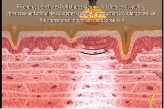 “小脸梦”光靠护肤品怎么够？美容仪才是留住青春的神助攻