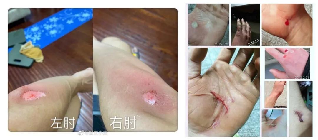 四川小伙坚持七年倒立走路,单手倒立保持吉尼斯世界纪录