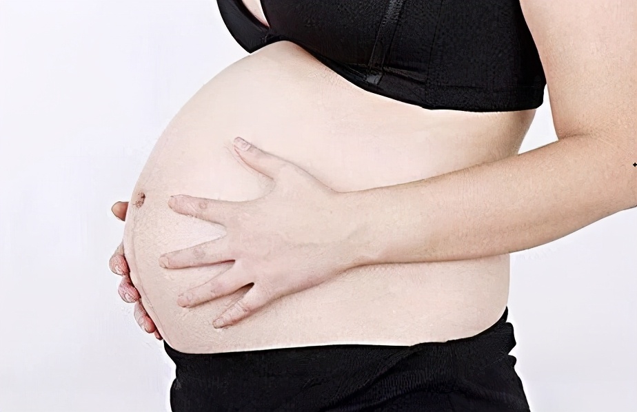 有没有去妊娠纹的好的推荐,治疗妊娠纹哪个产品有用求推荐