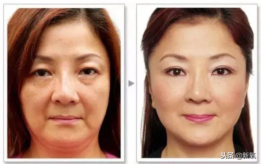 辛芷蕾是苦相女生吗,辛芷蕾气质怎么养成