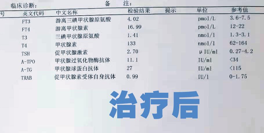 23岁女孩患甲亢的真实案例,孩子一岁三个月妈妈检查出甲亢