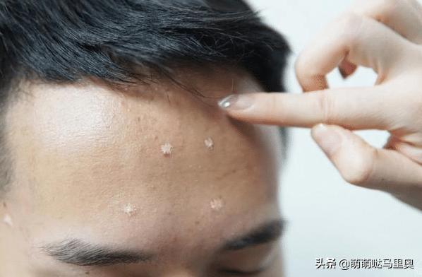 男士皮肤保养全攻略,男士皮肤6大问题