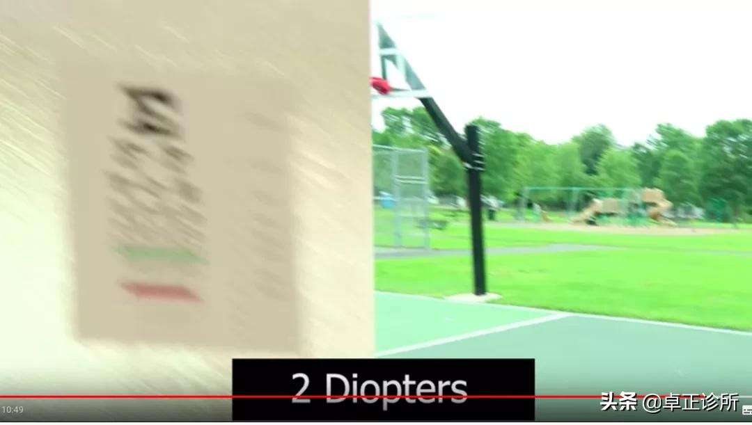 怎么按摩眼睛改善散光,怎么锻炼眼睛能改善散光