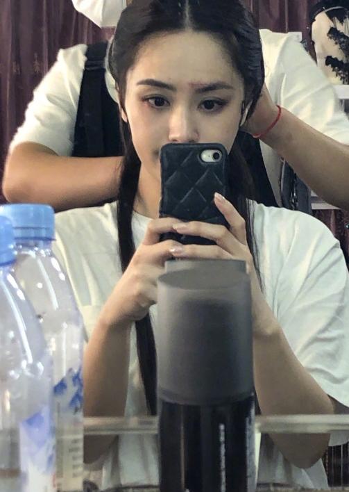 医美专家爆阿娇6㎝伤口肯定留疤痕,激光也难以恢复平滑肌肤